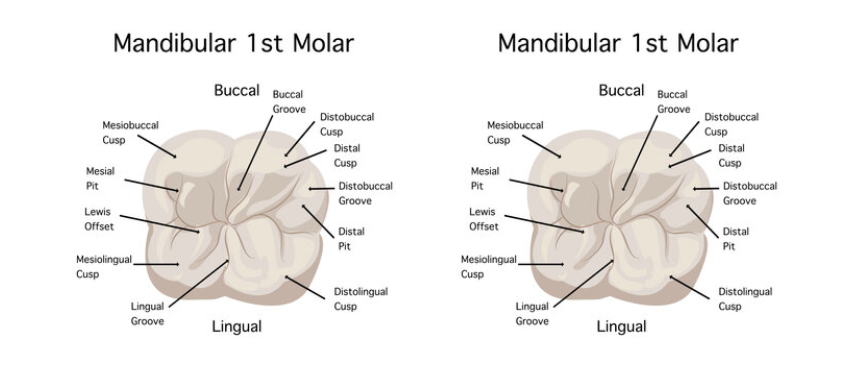 Imagine the two molars next to each other. There would be a gap between the two out-jutting parts on the side.