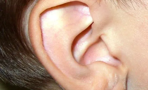 Smooth ear example 2